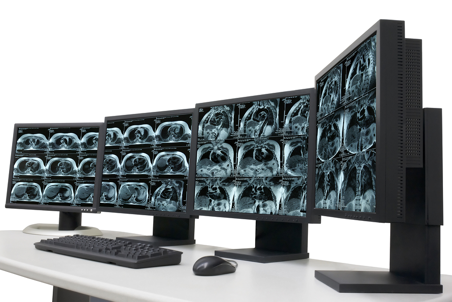 several monitors with magnetic resonance images